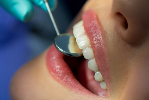 Laser teeth whitening at Mitcham Central Dental – cosmetic dentist Mitcham VIC