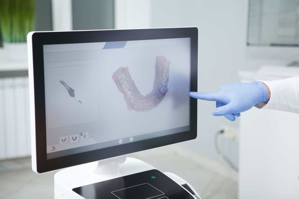 Dental scan review at Mitcham Central Dental – digital X-ray technology
