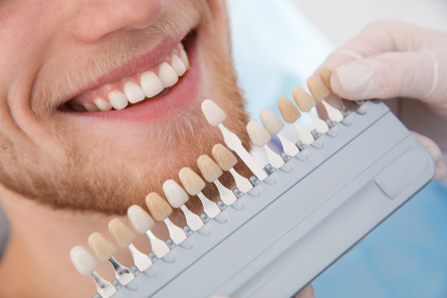 Dentist,Selecting,Patient's,Teeth,Color,With,Palette,In,Clinic,,Closeup